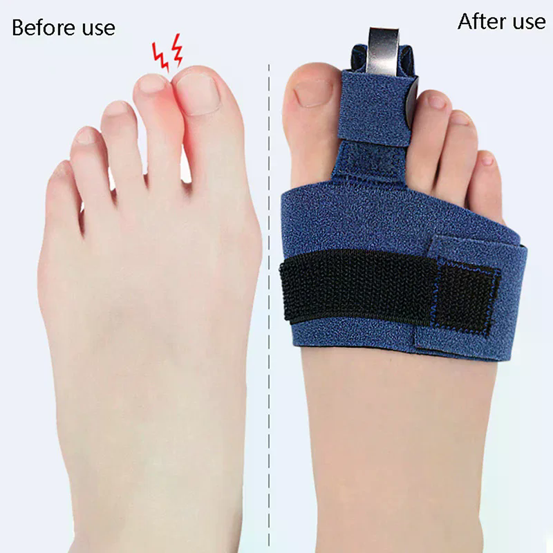 Correcteur d'orteils, fixateur - Ankle Brace Sock avis et prix